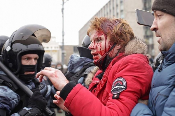 В Москве после акции в поддержку Навального в больницы обратились более 40 человек В Москве после акции в поддержку Навального в больницы обратились более 40 человек0