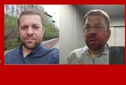 В ХМАО избили оппозиционного журналиста и общественного активиста В ХМАО избили оппозиционного журналиста и общественного активиста